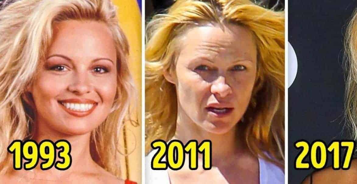 Porównanie wyglądu gwiazdy w latach 1993, 2011 i 2017.