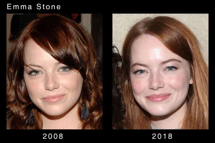 Porównanie zdjęć Emmy Stone z 2008 i 2018 roku.